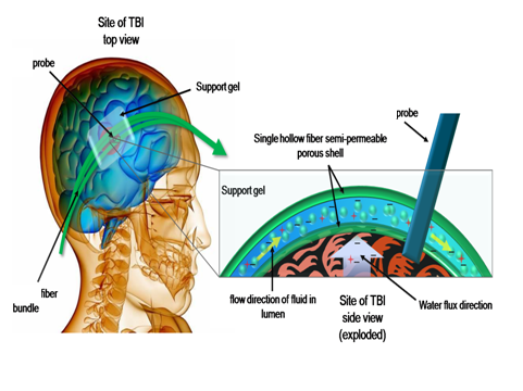 herniation of brain. rain herniation,